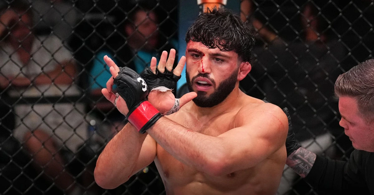 Arman Tsarukyan Explains Why Controversy Can Turn UFC Fighters Into Stars.